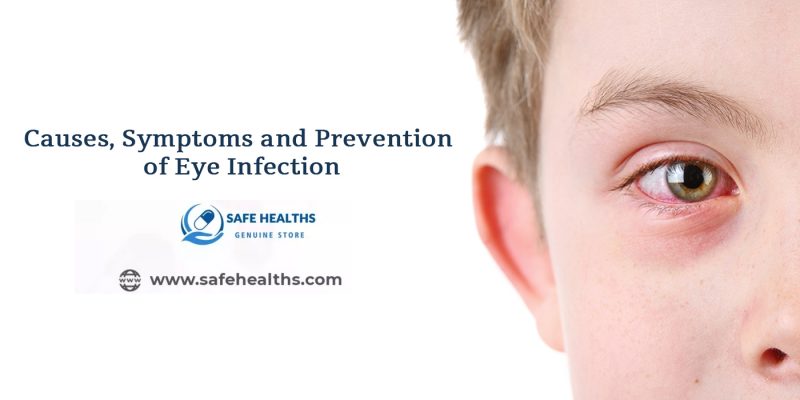 Causes, Symptoms and Prevention of Eye Infection
